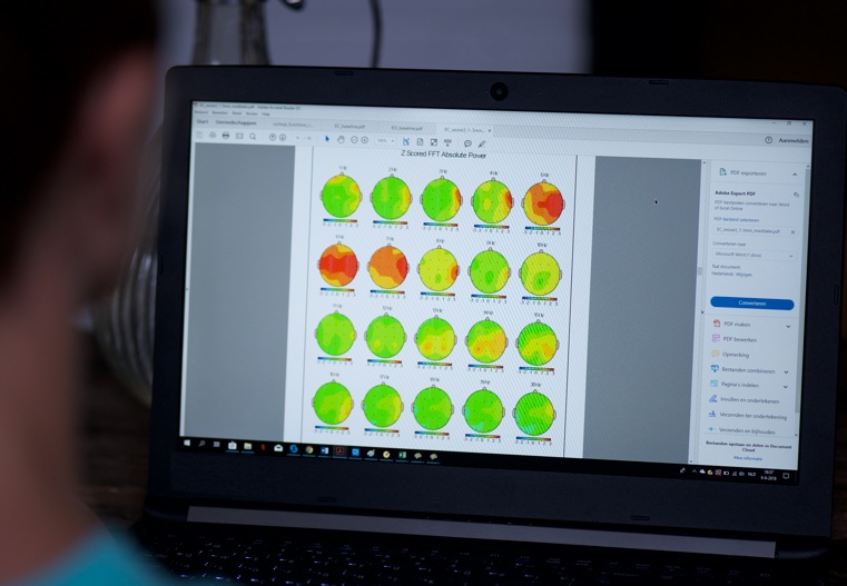 Een QEEG-rapport met hersenkaarten per frequentie, bekeken op een laptopscherm.